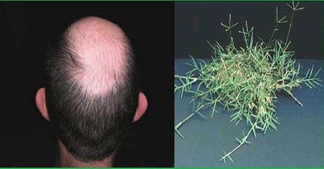 টাক ও বহুবিধ রোগ থেকে মুক্তি দিতে পারে দুর্বা ঘাস