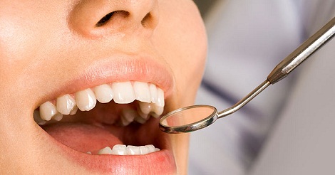 দাঁতের ৬ রকম সমস্যা দূর করতে এই কাজটি করুন সকালে খালিপেটে