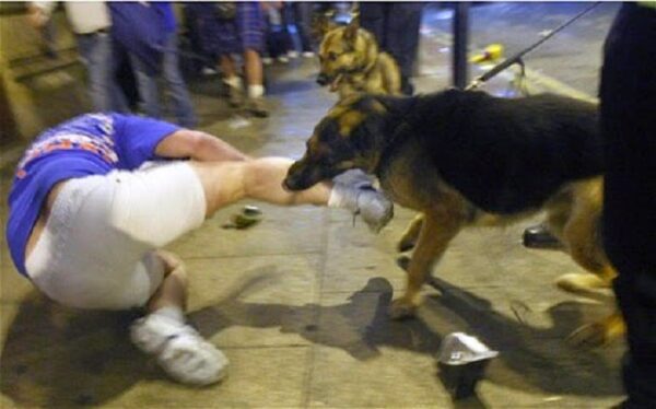 কুকুর কামড়ালে মানুষের পেটে বাচ্চা হয়!