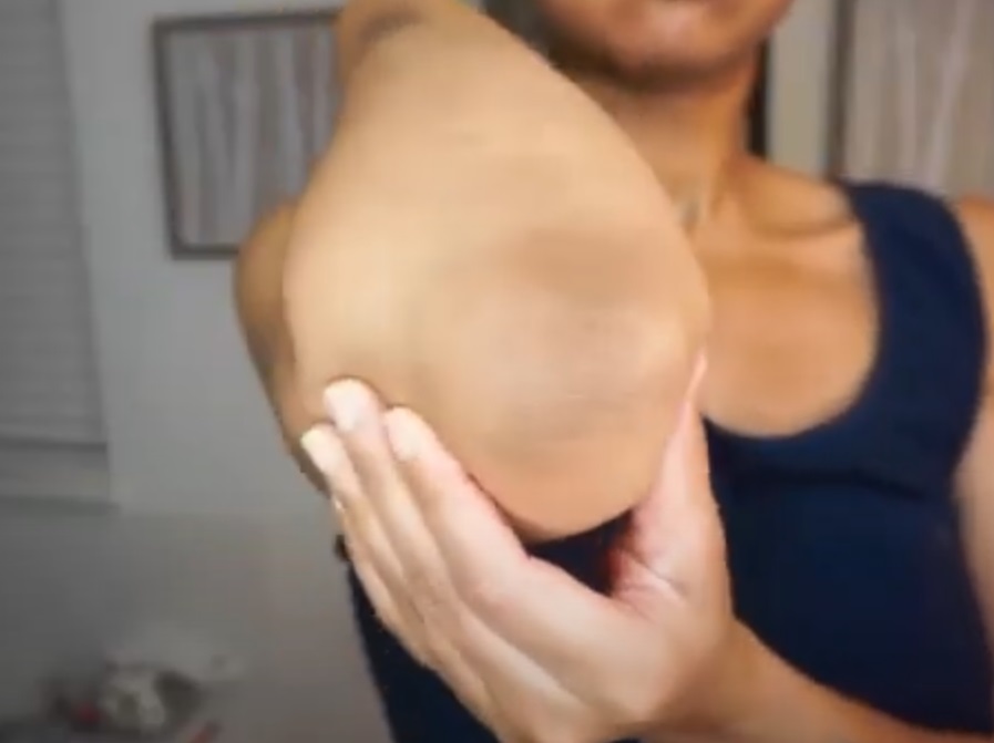 ঘরোয়া উপায়ে দাগ মুক্ত  করুন কনুই, হাটু ও গোড়ালি