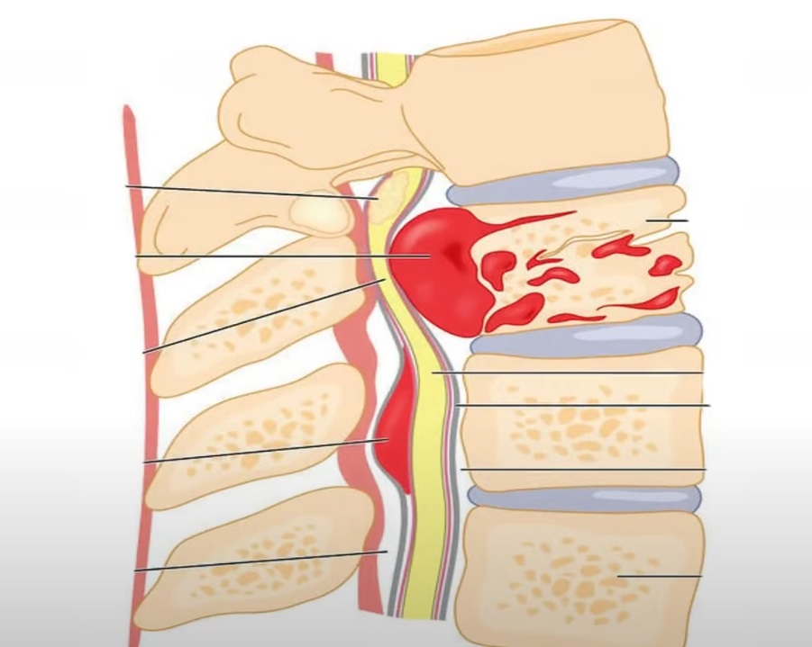 পিঠব্যথায় ভুগছেন  জেনে নিন কারণ ও মুক্তির উপায়